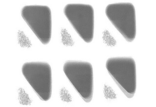 identification of substandard filling thanks to Dymond